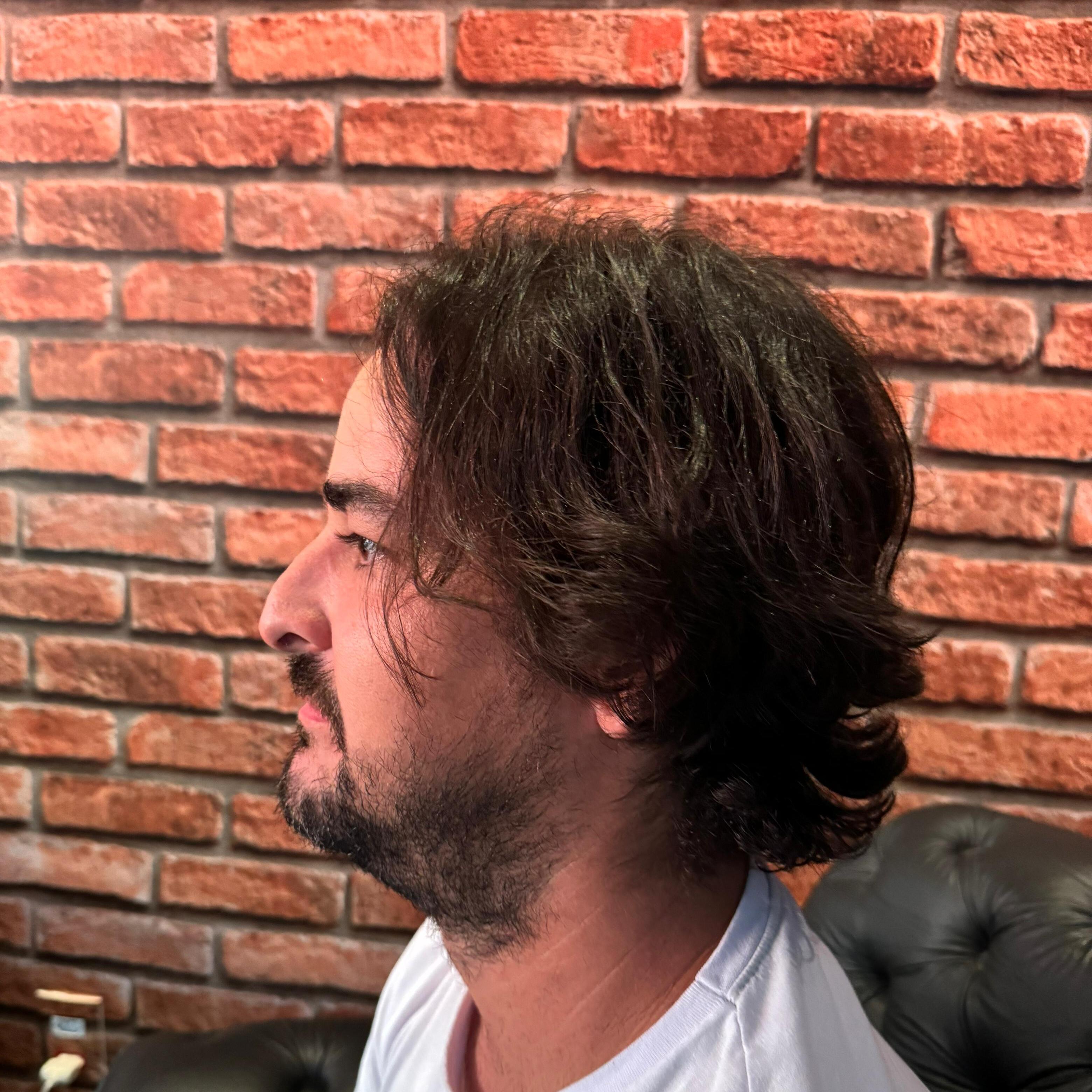 Antes da transformação 2